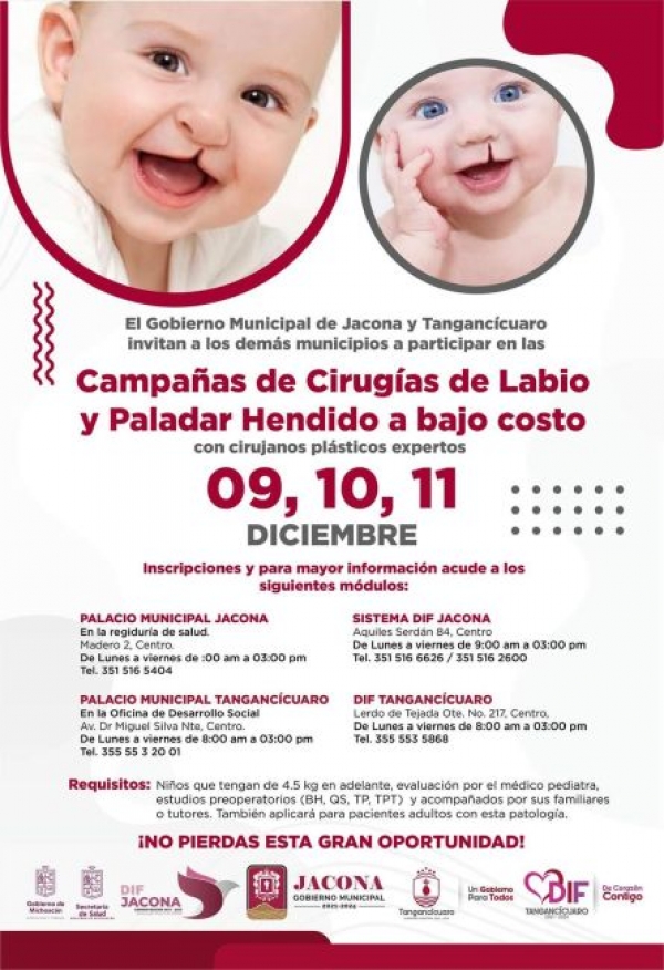 Los Gobiernos Municipales de Jacona y Tangancícuaro, invitan a la población a participar en las Campañas de Cirugías de Labio y Paladar Hendido